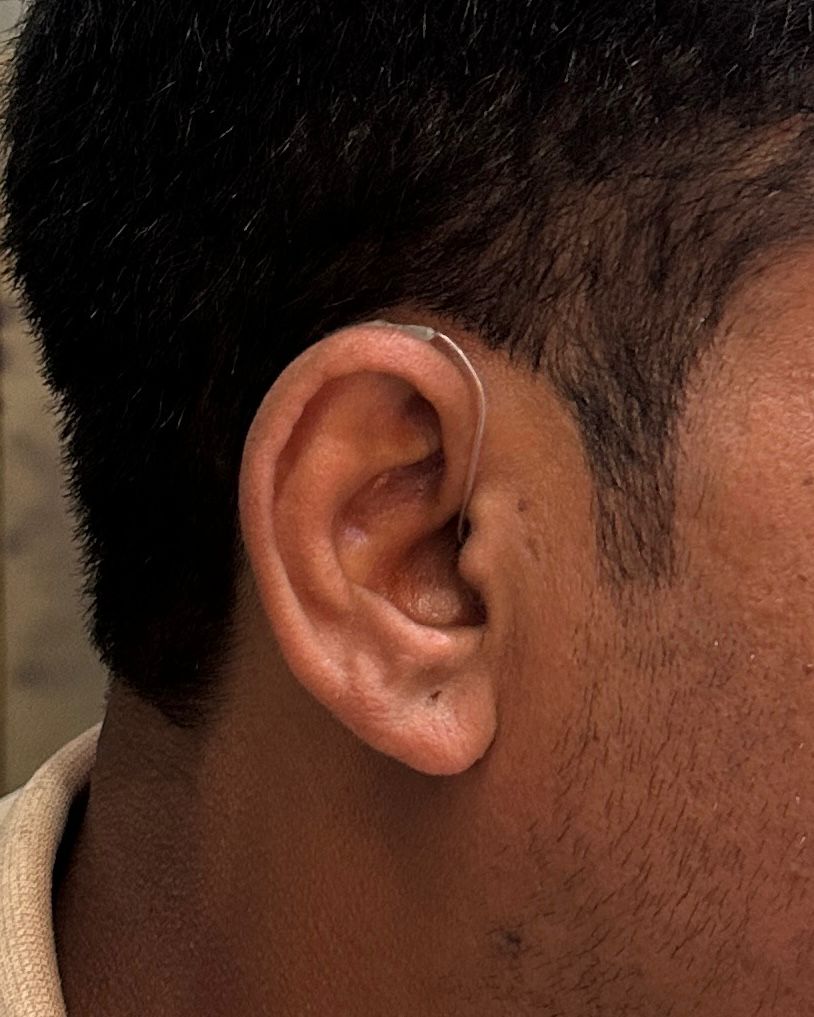 Hearing Aid 9