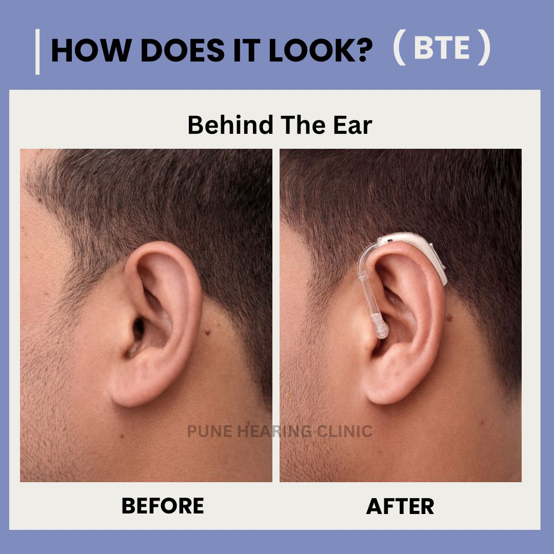 Behind The Ear